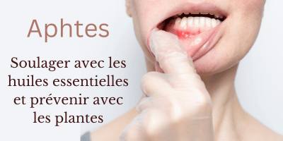 Aphtes: soulager avec les huiles essentielles et prévenir avec les plantes